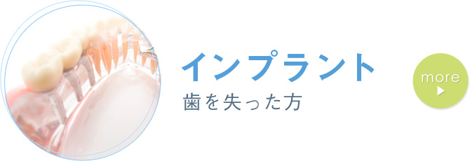 インプラント 歯を失った方