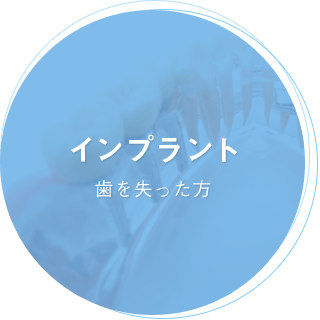 インプラント 歯を失った方